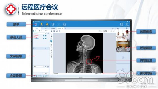 中医远程诊疗系统平台，革新医疗模式，助力健康中国建设