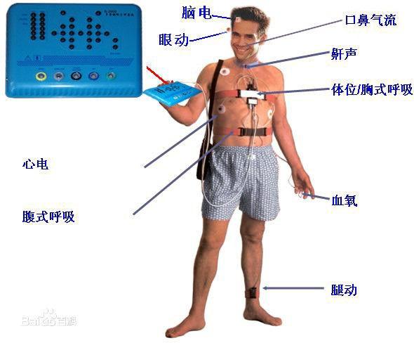 健康状态监测功能详解