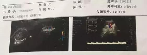 远程胎心监护准吗