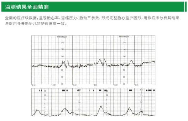 远程胎心监护，科技力量守护母婴健康