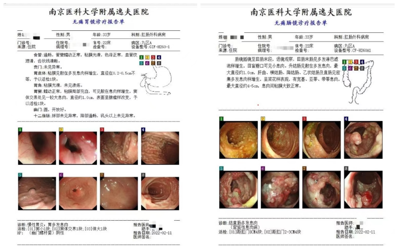 肛门健康咨询，了解、探索与关怀之道